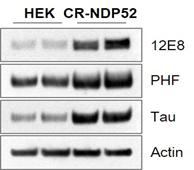 NDP52 knockout에 의한 p-tau 단백질 발현 증가