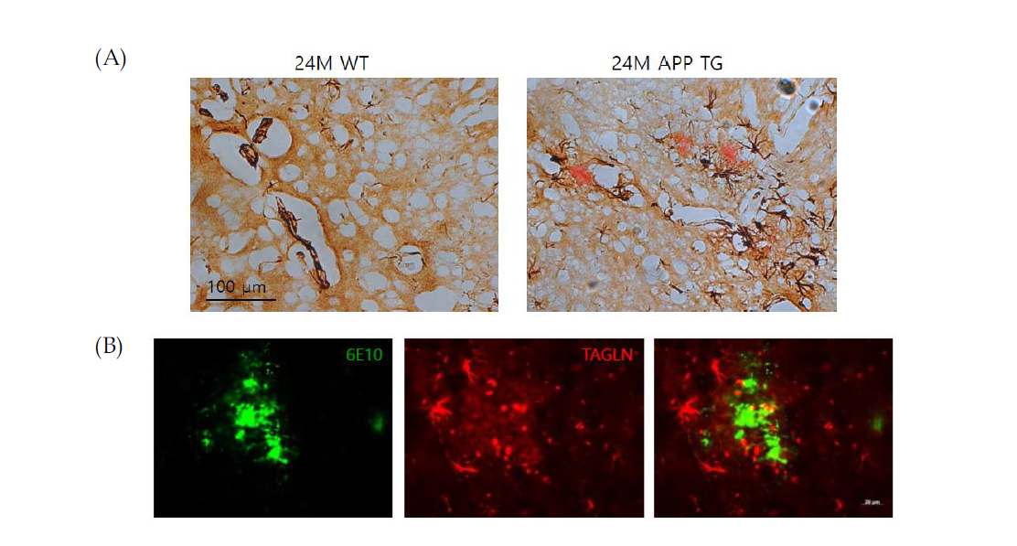 APP TG mouse brain에서 TAGLN 발현 확인 (A) DAB staining (B) Immunofluoroscence staining