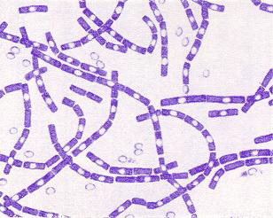 Bacillus anthracis. Gram stain. 1,500 x