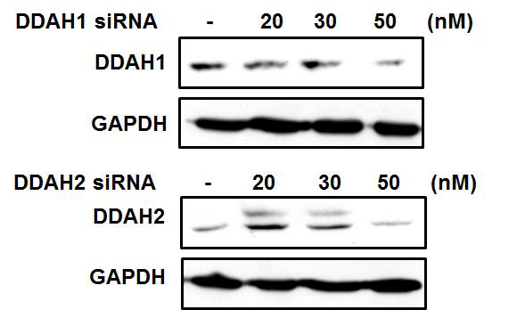 DDAHs의 siRNA를 통한 DDAHs의 발현 억제