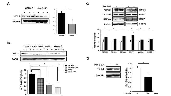 Change of hepatic Kv 3.2 expression in obese mice and palmitate treated liver cells.