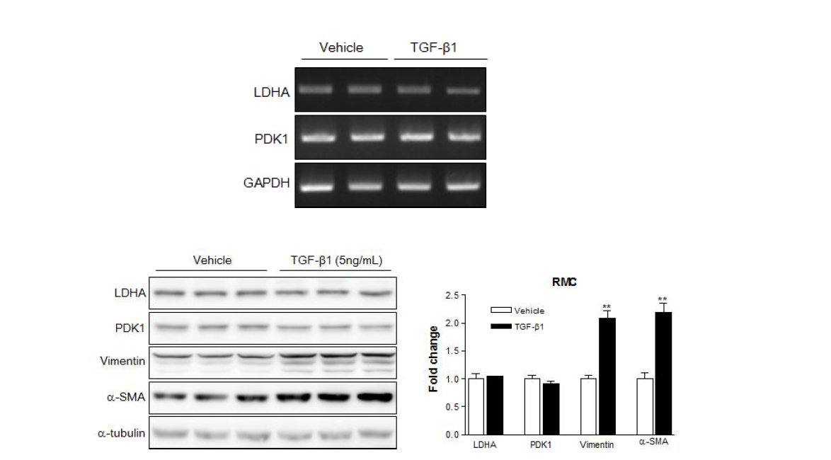 신장세포주에서 TGF-b1처리에 의한 섬유화, 해당과정 관련 유전자 및 단백질의 변화