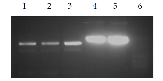 Confirmatory PCR profiles for the hGAPDH and hRV RNA after DNase-I treatment