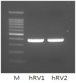 Confirmation of hRV viral cDNA in the SISPA-PCR product