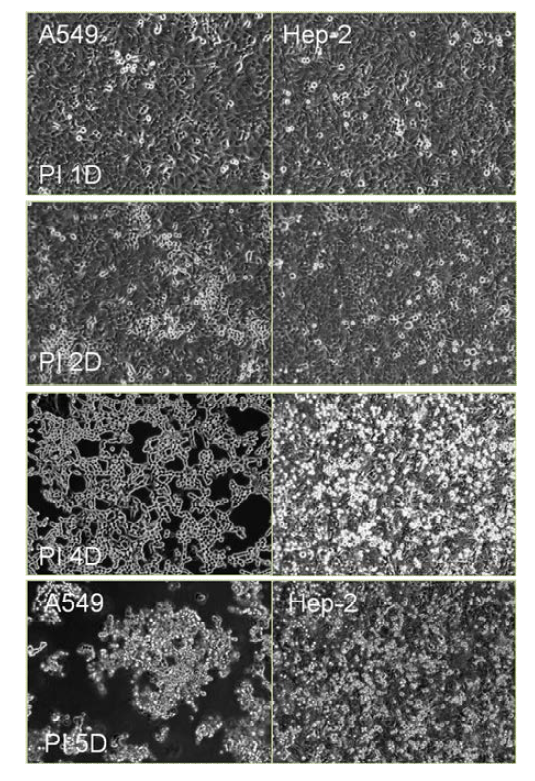 Replication of human Adenovirus serotype 3 in A549 cells and Hep2 cells