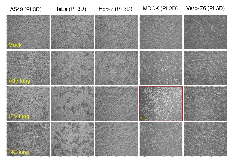 Cells on PI 3days after the inoculation of mice lungs infected with hAd3 and IFV