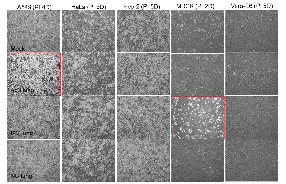 Cells pictures after the 2nd blind-test of cell supernatant inoculated with mice lungs