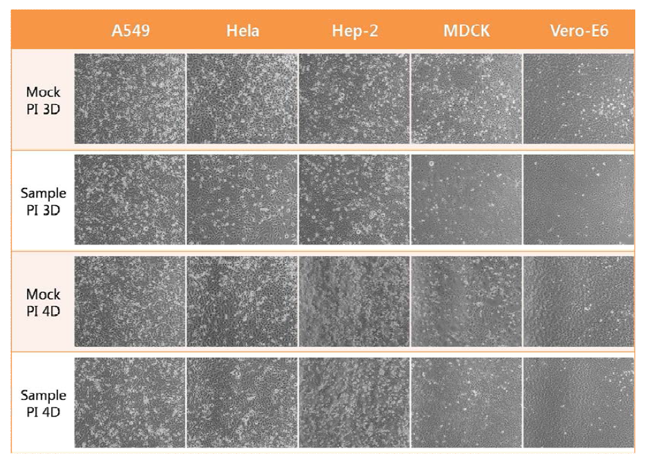 Result of 1st inoculation with the patients’ samples in five cell lines (Mag. 100X)