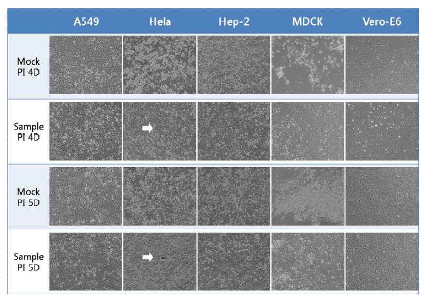 Result of 2nd inoculation with 1st inoculated cells and media (Mag. 100X)