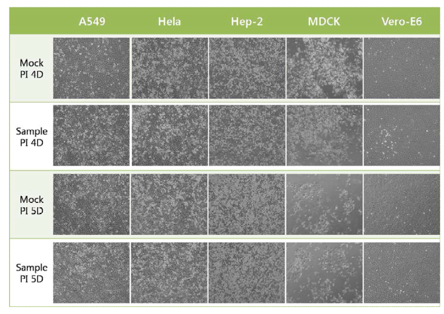 Result of 3rd inoculation with 1st inoculated cells and media (Mag. 100X)