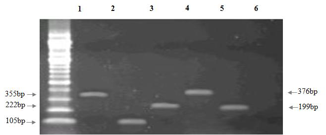 Amplification of qnrA, qnrB, qnrS, aac(6’) Ib-cr, qepA genes