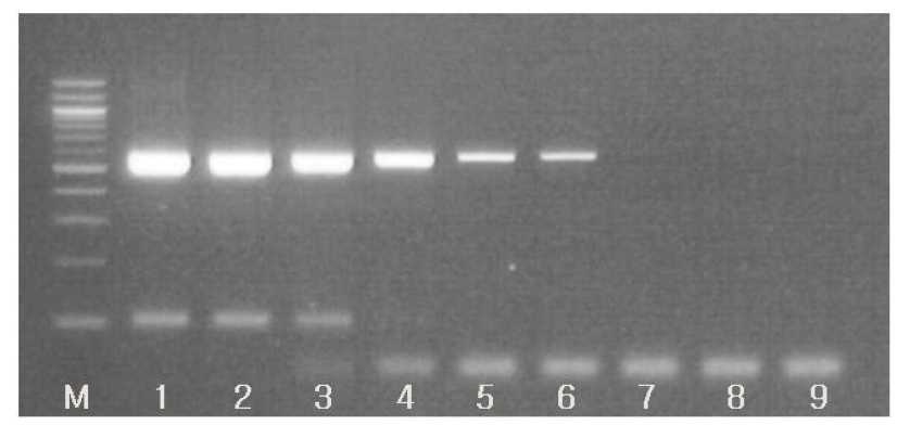 RT-PCR에 의한 홍역바이러스 유전자 검출의 sensitivity