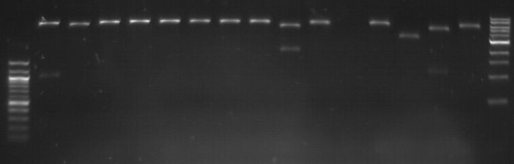 pET 100/D-TOPO Cloning MeV 2k5 213 truncated M gene fragment 2k5 full M gene fragment
