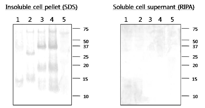 HiFive cell에 대량 발현된 SSPE 홍역바이러스의 truncated matrix 단백질과 full-length matrix 단백질