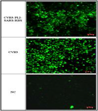 Antigenicity of SARS-CoV RBD/CVB3 hybrid using anti-CVB3 antibody