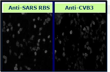 Antigenicity of SARS-CoV RBD/CVB3 hybrid using anti-CVB3 as well as anti-SARS-CoV spike protein antibody