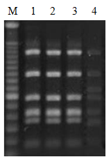 RFLP of PCR products obtained between vanR and vanX in vanA cluster of vanA-type VSE and VRE isolates