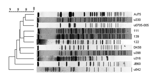 PFGE patterns of vanA-type VSE isolates