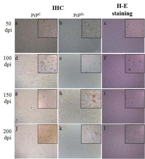sCJD 표준 뇌 검체 접종 마우스(129M TgHuPrP_42)의 조직 병리학적 분석 결과