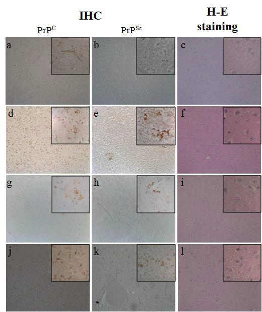 vCJD 표준 뇌 검체 접종 마우스(129M TgHuPrP_42)의 조직 병리학적 분석 결과