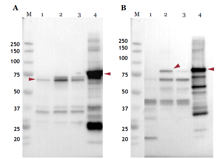 The expression comparison of CsHSP70 and CsHSP90 between healthy and wounded worm of C. sinensis