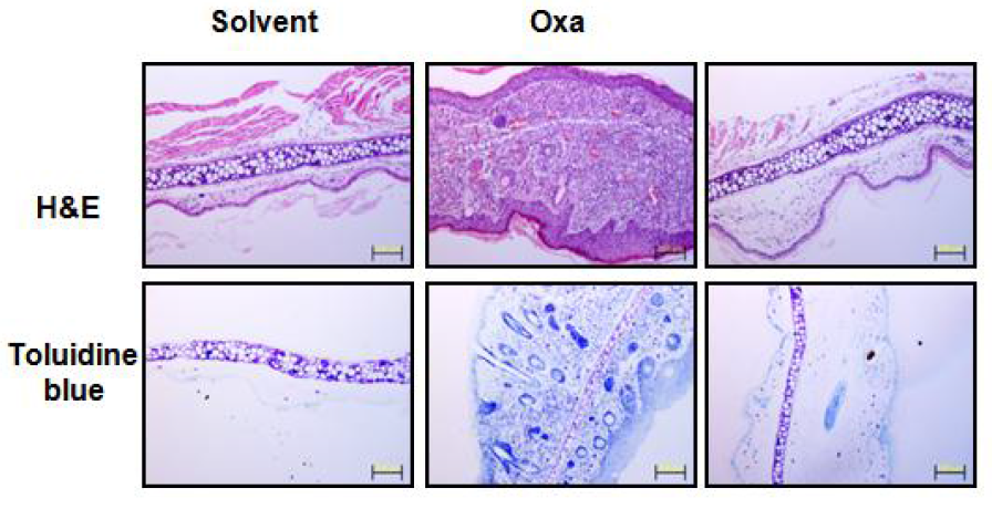 Oxazolone-induced CHS 동물 모델을 통한 CsVAL 면역화에 따른 피부염 유발 조직내 염증성 세포 침윤 억제효과