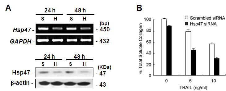 siRNA를 이용한 Hsp47 억제에 의한 콜라젠 생성 감소 효과