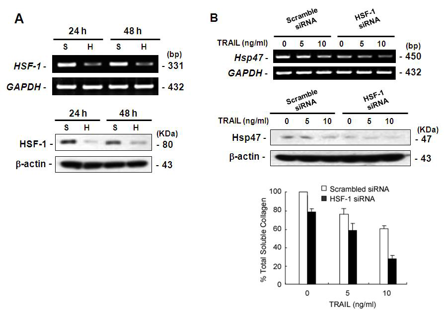 HSF-1 유전자 발현 억제에 따른 Hsp47 및 콜라젠 분비에 끼치는 영향