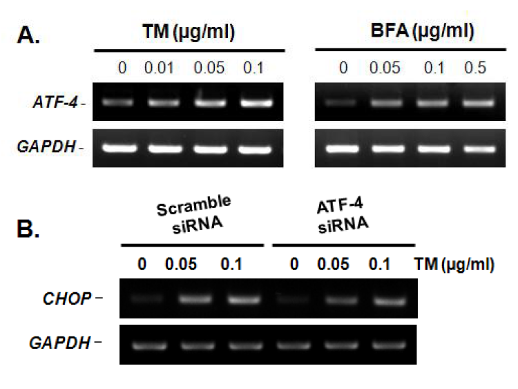 ATF4의 전사적 조절에 의한 CHOP의 유전자 발현 변화