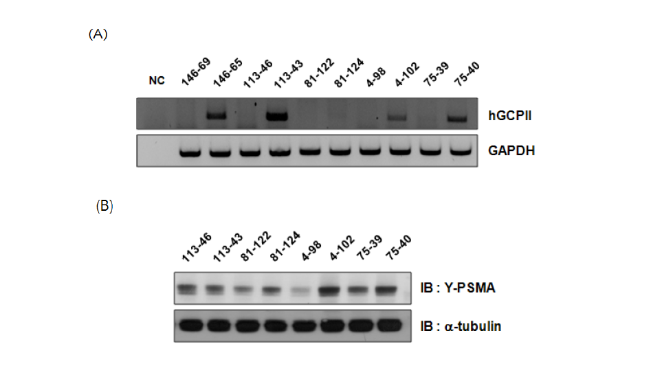 GCPII 형질전환 founder 쥐의 line 별 발현 정도 비교 (A) RT-PCR을 이용하여 RNA 발현정도 확인 (B) western blotting을 이용하여 단백질 발현정도 확인