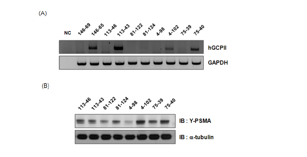 GCPII 형질전환 founder 쥐의 line 별 발현 정도 비교 (A) RT-PCR을 이용하여 RNA 발현정도 확인 (B) western blotting을 이용하여 단백질 발현정도 확인