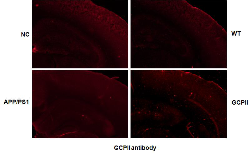 GCPII 형질전환 쥐의 cortex 에서의 GCPII 발현 확인