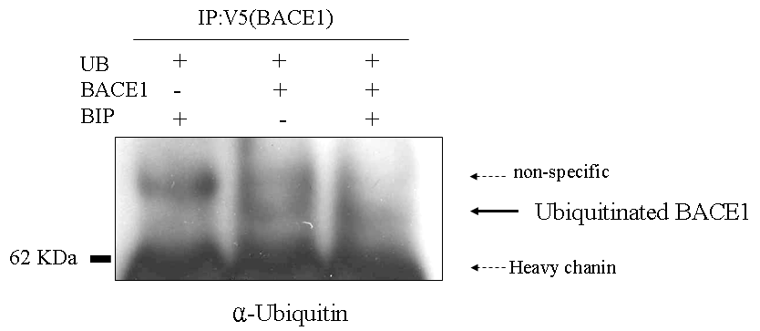 BACE1과 ubiquitin 결합에 대한 BIP의 저해분석