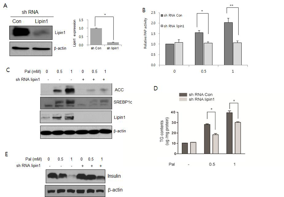 Lipin발현을 억제시켰을 때 지질대사의 변화
