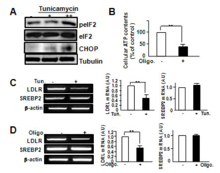 Organelle stresses reduce LDLR expression