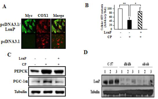 Overexpression of LonP rescues hepatic insulin resistance