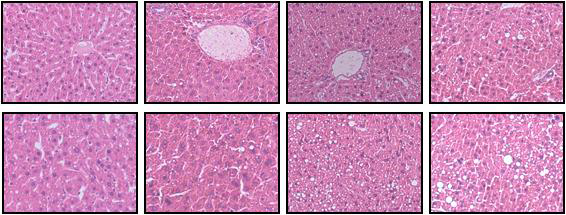 Liver histology