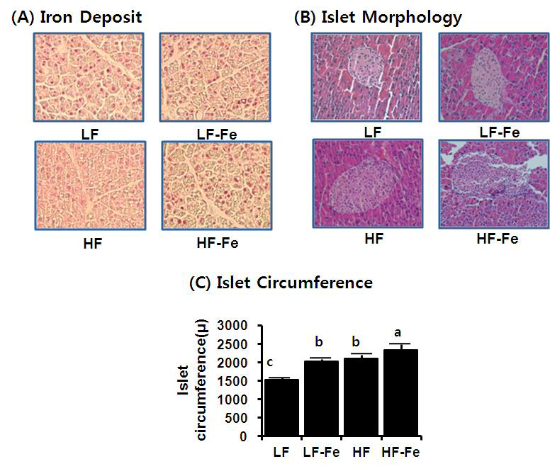 Iron storage and islet morphology