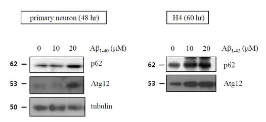 신경세포에서 아밀로이드베타에 의한 P62변화