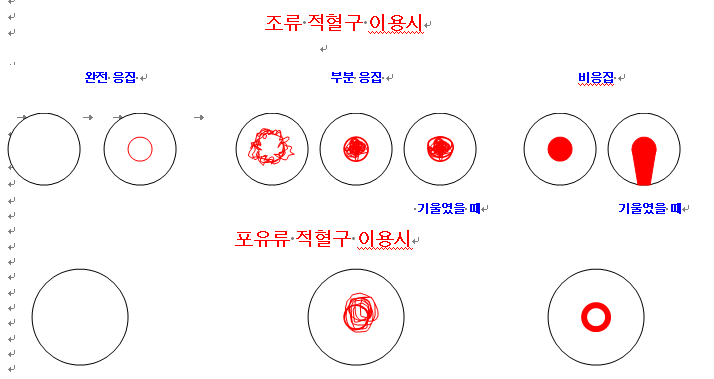 혈구응집시험에 의한 적혈구 패턴