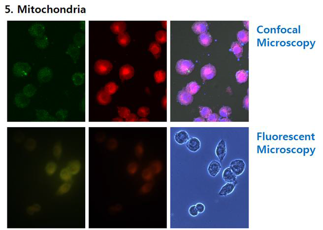 The results of mitochondria immuno histochemistry (DAPI staining for nucleus, FITC for Brucella and rhomamine for mitochondria)