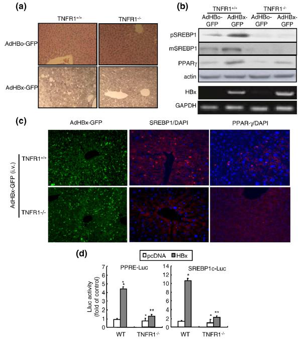 TNFR1 siRNA inhibits lipid accumulation and expression of lipogenesis genes observed in HepG2-GFPHBx stable cells