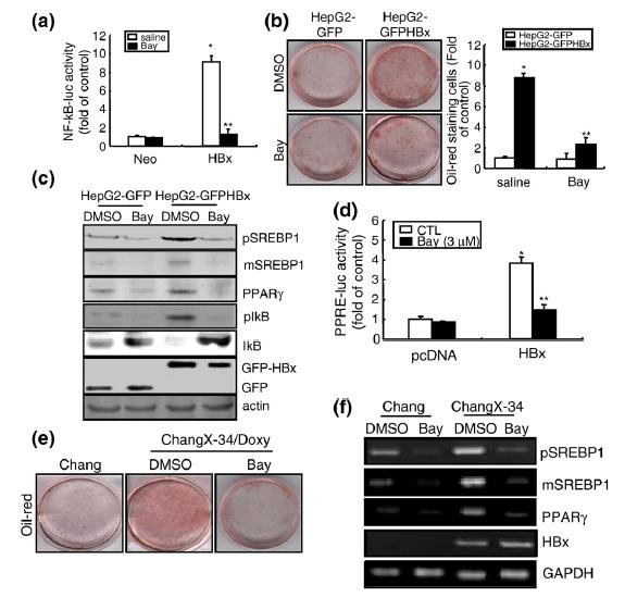 HBx-induced steatosis is abolished in TNFR1-/- mice