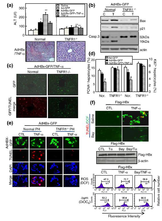 TNF-α potentiation of HBx-induced apoptosis was regulated by the TNFR1-dependent pathway