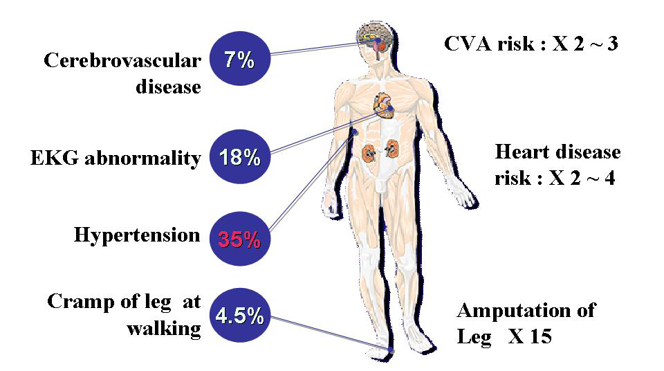 Risk ratio of Diseases in type 2 Diabetes