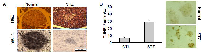 STZ treatment induced loss of islet cell's mass and β-cell apoptosis