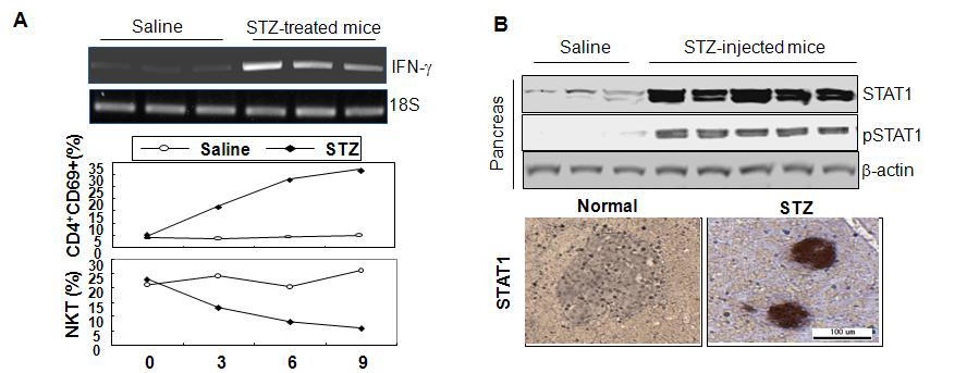 STZ treatment activates T-cell and increases IFN-γ-mediated STAT1 activation pathway