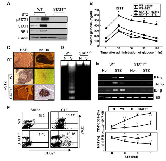 STAT1 is essential for STZ-induced β-cell dysfunction and apoptosis