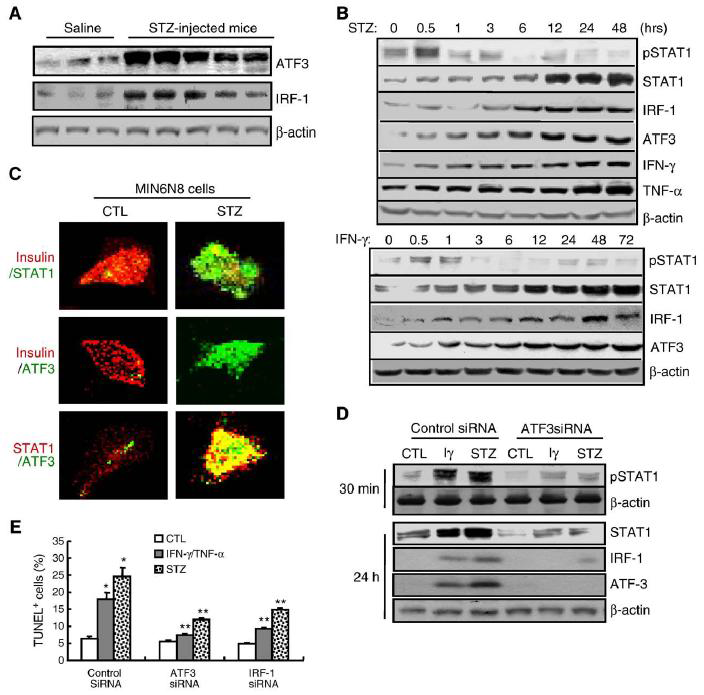 ATF3 is a potent regulator of STZ- or IFN-γ-induced STAT1 activation