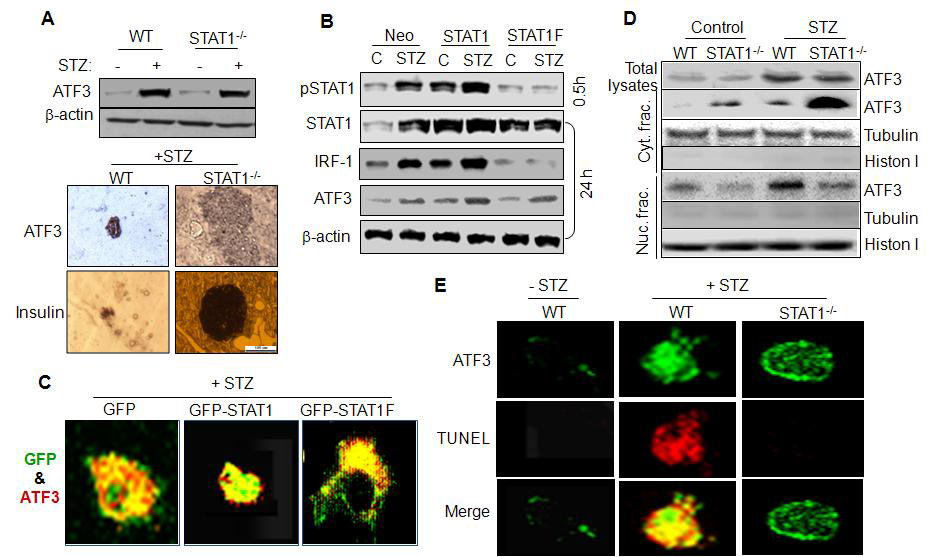 STAT1 is required for STZ-induced ATF3 nuclear translocation and β-cell apoptosis